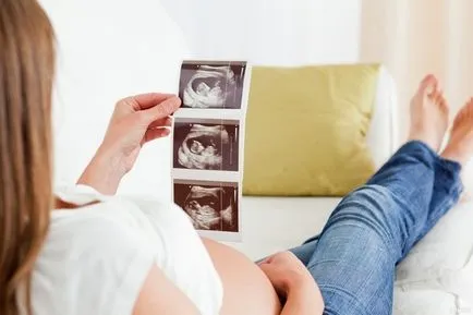 Ultrahang a terhesség harmadik trimeszterében Ultrahang a terhesség harmadik trimeszterében