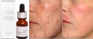 Whitening krém