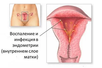 Hogyan szülni mentesítés
