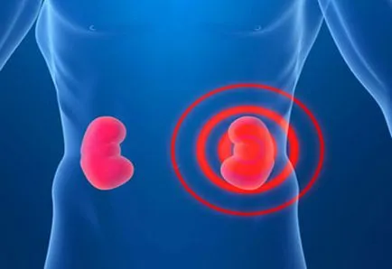 Hogyan és mit idült pyelonephritis