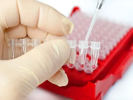 Hogyan és mit idült pyelonephritis