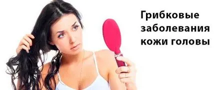 Mint kezelni fejbőr