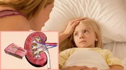 Vese kezelés gyermekeknél Vese kezelés gyermekeknél