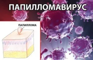 Tűnő papilloma nyakán