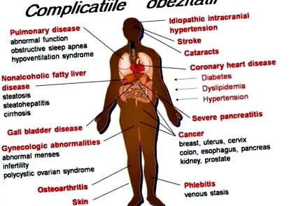 ризики ризики