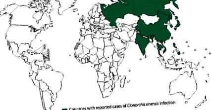 fascioliasis