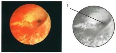 Mi endometrium szekréciós fázisban