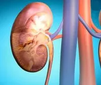 glomerulonephritis meg