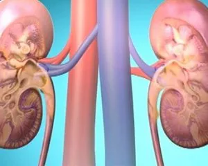 glomerulonephritis meg glomerulonephritis meg