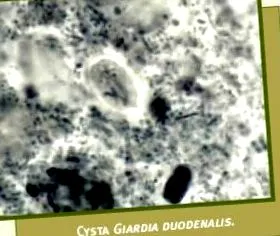 giardia
