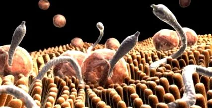 opisthorchosis