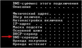 Honnan tudom, hogy az én dns-server
