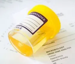 Hogyan növelhető a fehérvérsejtek a vizeletben