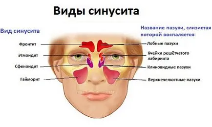 Hogyan, hogy felmelegedjen az orrod Hogyan, hogy felmelegedjen az orrod