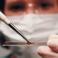 Hemoglobin, hogyan kell kezelni