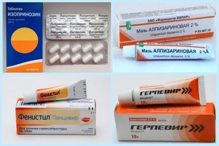 Herpes zoster zsindely kezelés