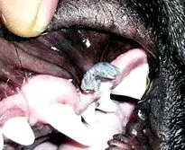 papilloma