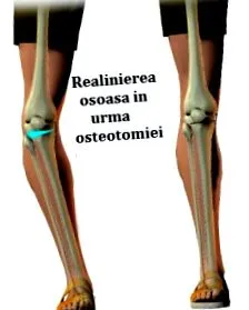 sípcsont