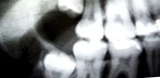 импликации