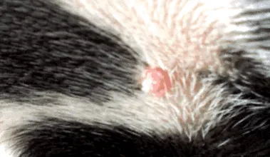 papilloma