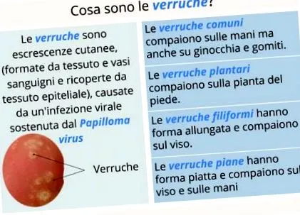 papilloma szemölcsök