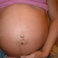 Hogyan lehet gyógyítani a köldök piercing Hogyan lehet gyógyítani a köldök piercing