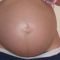 Hogyan lehet gyógyítani a köldök piercing Hogyan lehet gyógyítani a köldök piercing