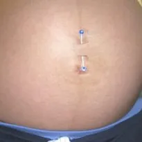 Hogyan lehet gyógyítani a köldök piercing Hogyan lehet gyógyítani a köldök piercing