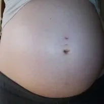 Hogyan lehet gyógyítani a köldök piercing Hogyan lehet gyógyítani a köldök piercing