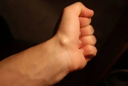 Mi a bőr alá