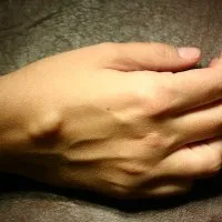 Mi a bőr alá Mi a bőr alá