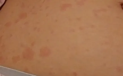 Kis test kiütés valamiből