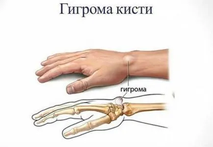 Dudorok a test, amit Dudorok a test, amit