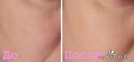 Vélemények krémek Avon Vélemények krémek Avon