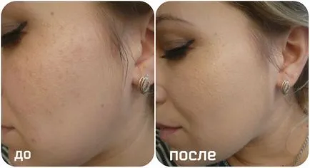 Vélemények krémek Avon