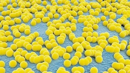 Mi a gyermek aureus