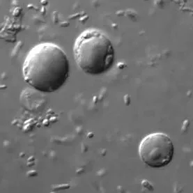 blastocystis