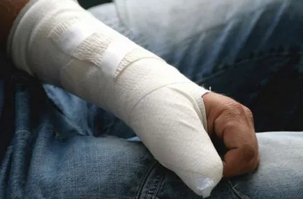 7. Ahol lehetséges, hogy bepereli a vétkes fél, és kártérítést fizetni