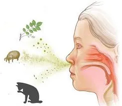 Az allergiás nátha tünetei és felnőttek kezelésére (allergiás rhinitis) Az allergiás nátha tünetei és a kezelés felnőtteknél