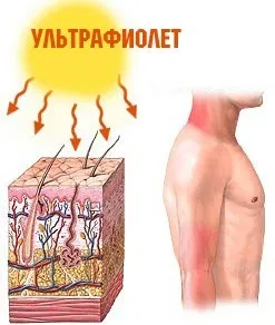 Allergia a nap otthoni kezelés, allergia kezelés