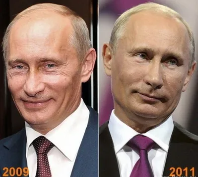 Cseljabinszk sebész feltárta a titkot személy Vladimira Putina - hírek