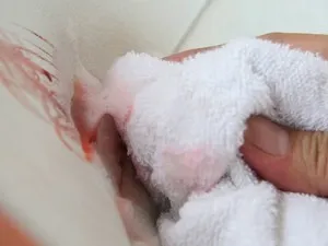 Hogyan mossa a vért a kanapéról, és vezető helyet