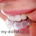Mi a teendő, ha a fogak esik (esnek) Mi a teendő, ha a fogak kihullanak