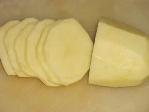 Mi van, ha égek forró vízzel otthon
