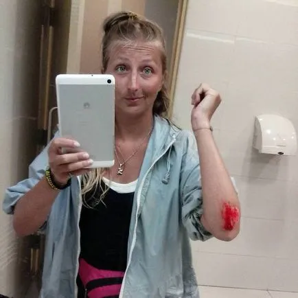 Mi a teendő baleset moped! A feneketlen tapasztalat (baleset) Mi a teendő baleset moped! A feneketlen tapasztalat
