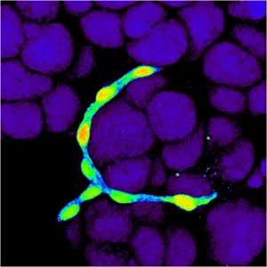 Mit tudok enni pancreatitis termékek listája