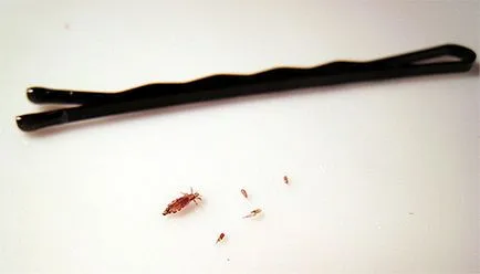 Mit jelentenek a jelek a megjelenése ellen (népi előjel) Mit jelentenek a jelek a megjelenése tetvek