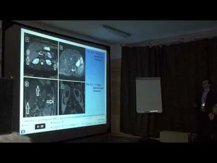 Mit jelent a MRI a máj, és ez jobb, ha nem CT vagy MRI