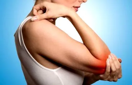 arthritis