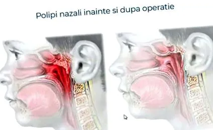 kezelésére
